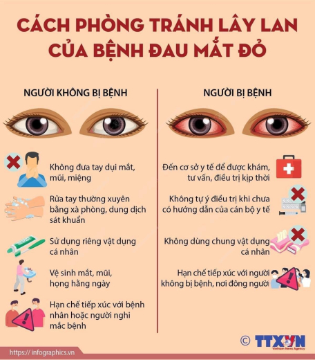 Bệnh đau mắt đỏ: triệu chứng, nguyên nhân và những lưu ý cần biết